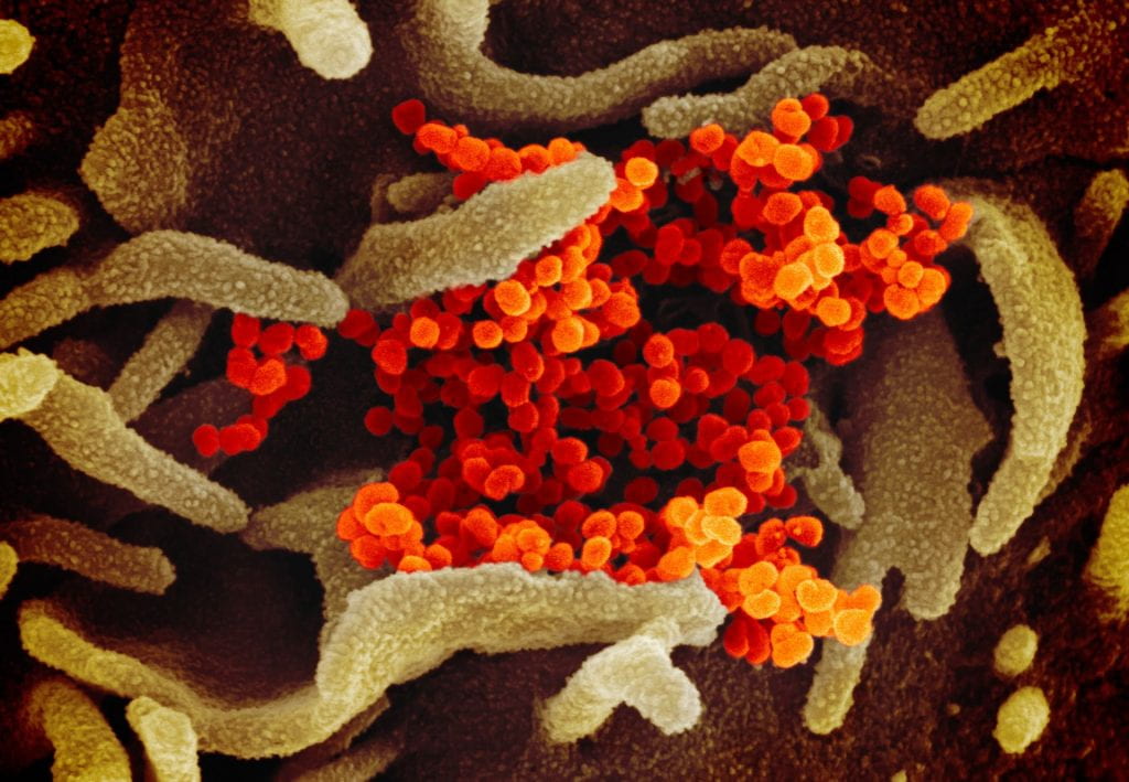 Virus Corona versi National Institute of Allergy and Infectious Diseases (NIAID)